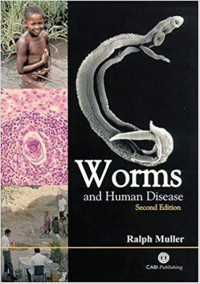 Worms and Human Disease